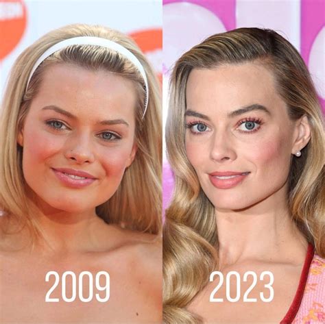 margot robbie before and after surgery|Margot Robbie Plastic Surgery: Separating Fact from Fiction